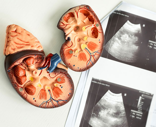 Kidney ultrasound
